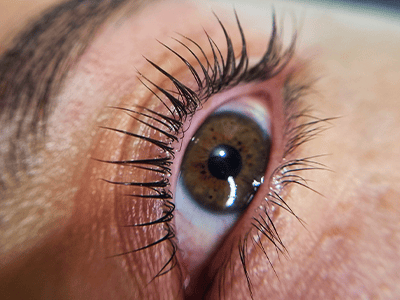 Tratamiento de Pestañas